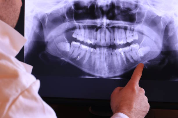 Best Emergency Treatment for Oral Infections in Ronan, MT