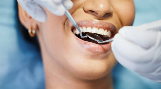 Best Emergency Dental Care for Sports Injuries in Ronan, MT